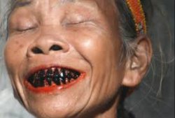 Черные зубы